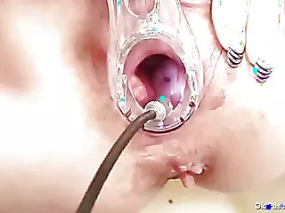 O femeie mai în vârstă, slabă, se confruntă cu un moment stânjenitor când secreția ei vaginală este observată de un ginecolog.